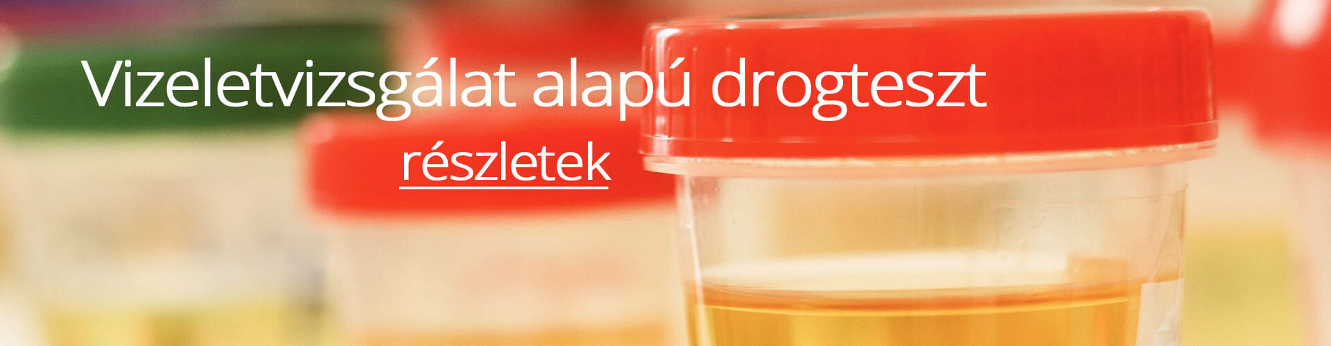 Drogteszt, vizeletvizsgálat