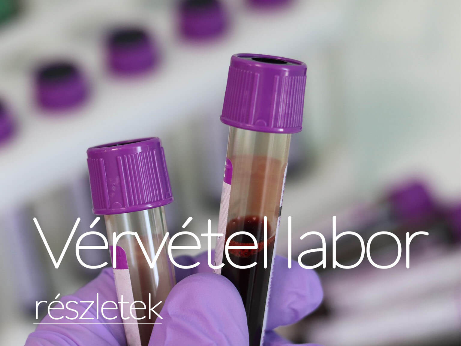 Szifilisz labor vizsglat | GM Labor Budapest, Veszprm