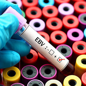 Epstein-Barr vírus (EBV) laborvizsgálat